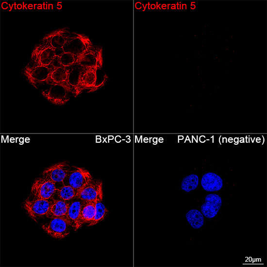 Cytokeratin 5 Rabbit mAb